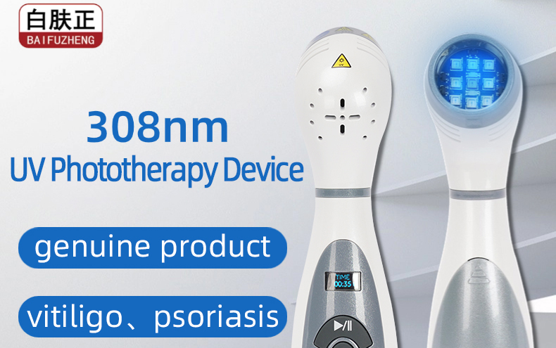便携式308nm光疗仪