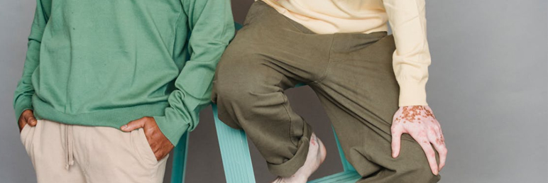 Is There a Difference Between Hospital 308 Phototherapy and Home Devices?