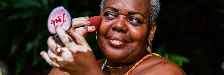 Is Vitiligo Contagious?